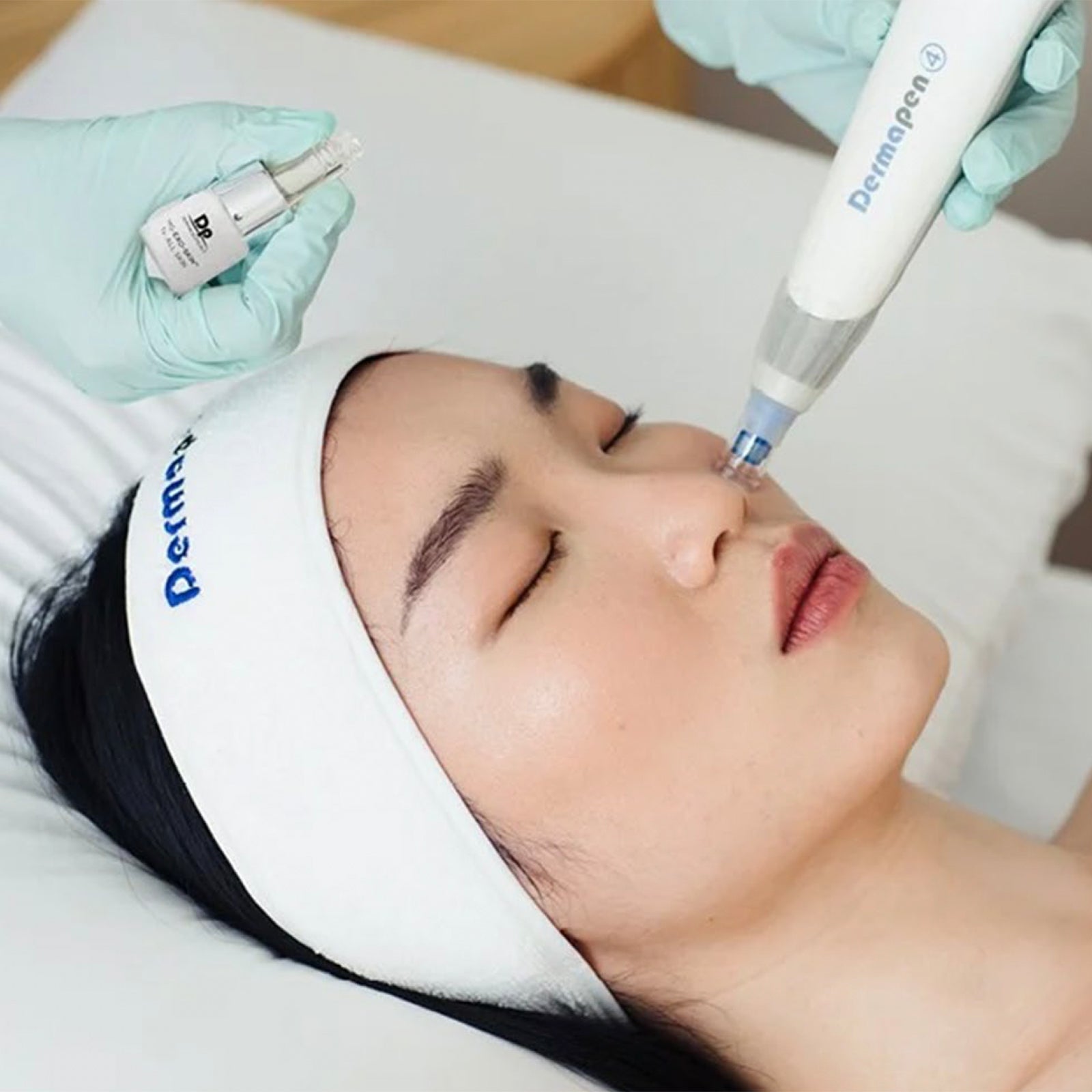 Microneedling med exosomer