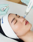 Microneedling med exosomer