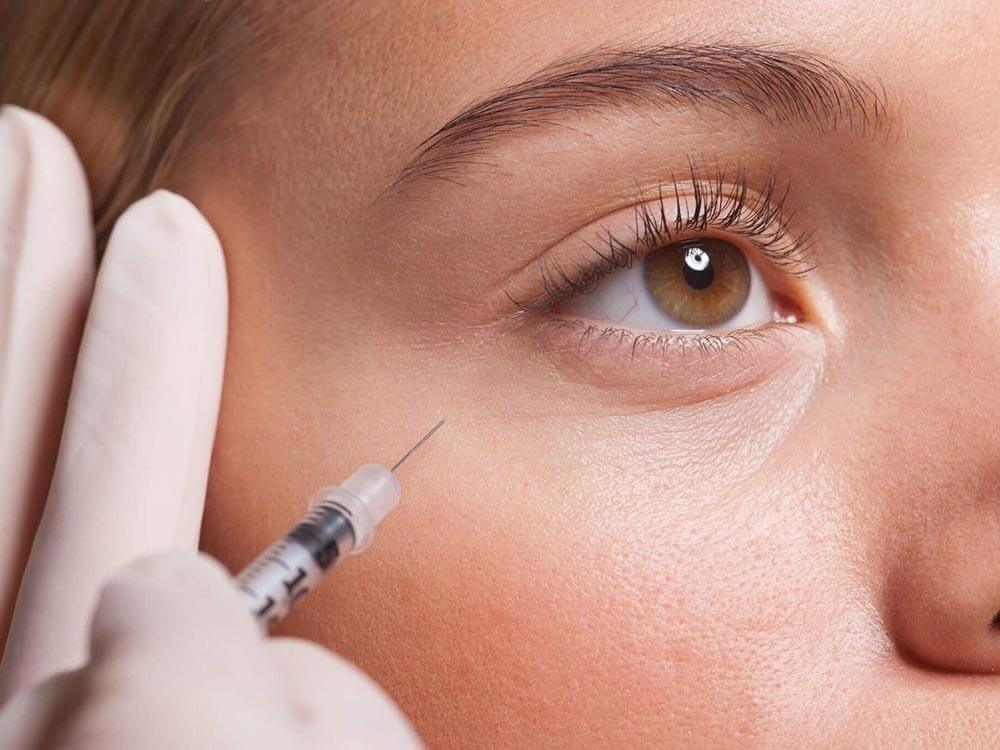 Restylane Tear Through